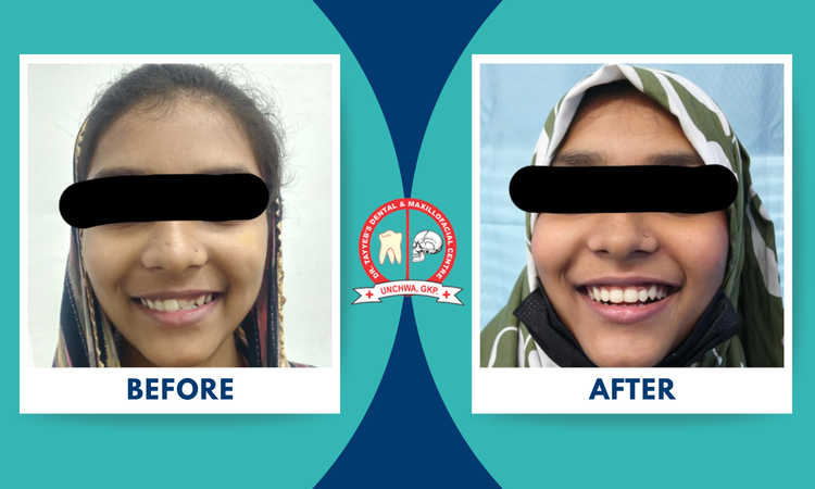 braces treatment at dr tayyeb's